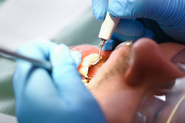 Professional Emergency Dental Service in GA