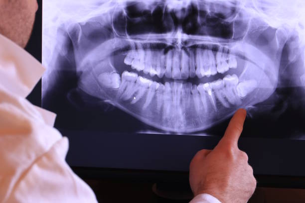 Best Dental Abscess Treatment in Conyers, GA