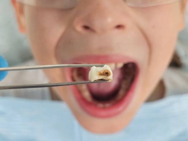 Best Emergency Treatment for Jaw Pain or Injury in Conyers, GA